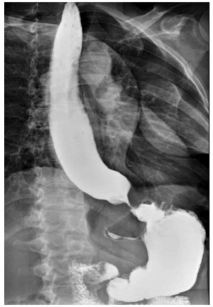 medical-reports-anemia-swallow