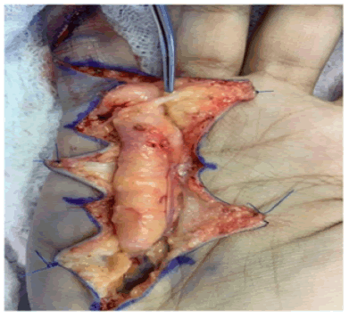 surgery-current-Intraoperative