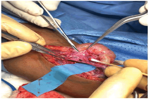surgery-current-microvascular
