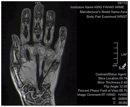 surgery-current-palm