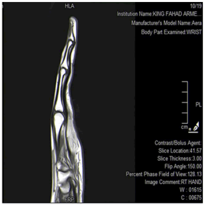 surgery-current-swelling