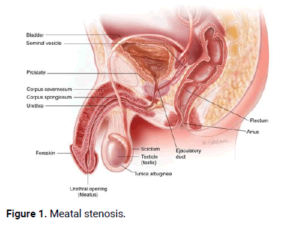 Dermatology-Case-Meatal