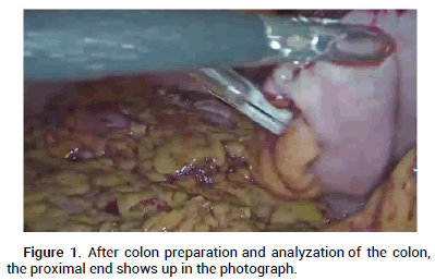 Reconstructive-Anaplastology-proximal