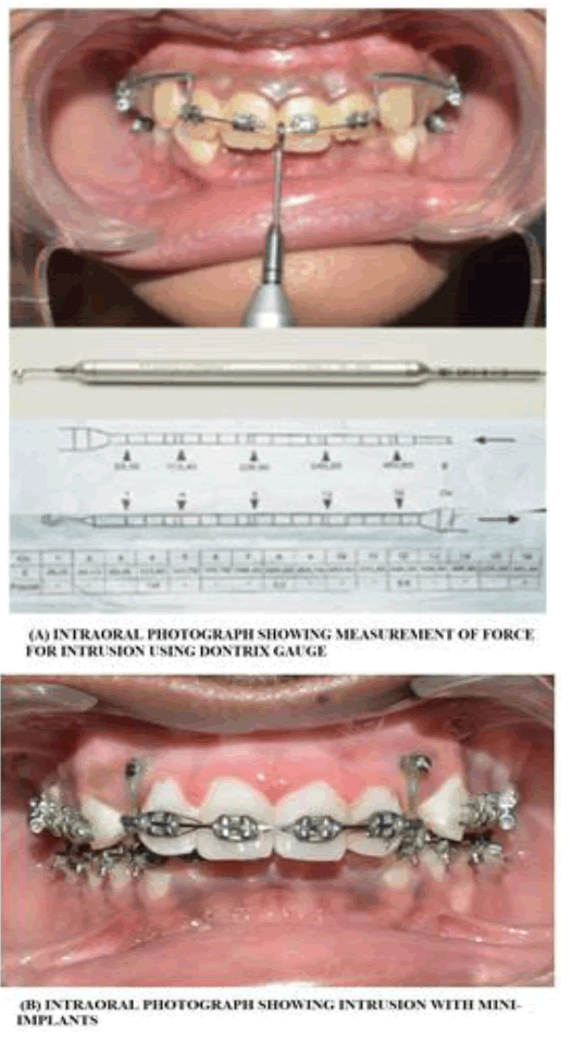 jdrp-5-1-Comparative-g004