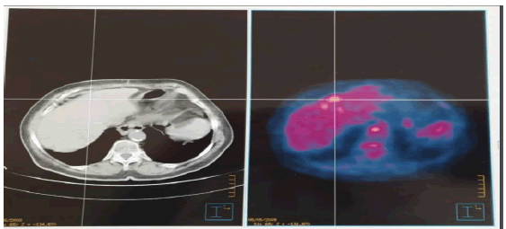 occrs-9-2-Prolonged-g001