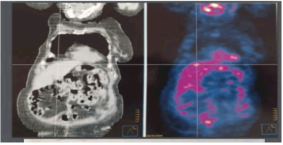 occrs-9-2-Prolonged-g002