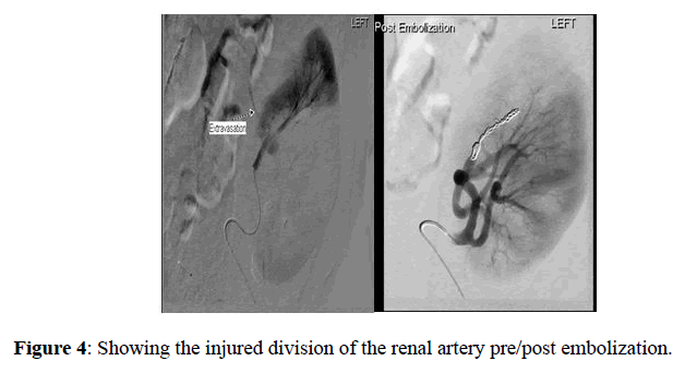 internal-medicine-public-health-artery