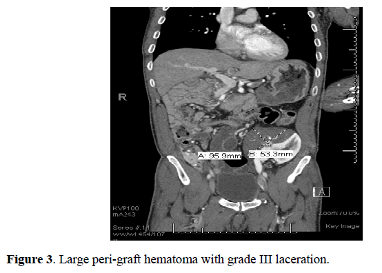 internal-medicine-public-health-hematoma