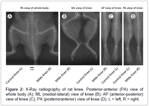 Full body marker set in (A) anterior (B) right lateral (C