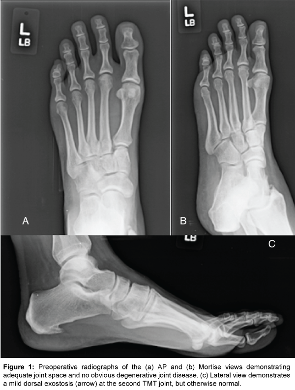 arthritis-mild-dorsal