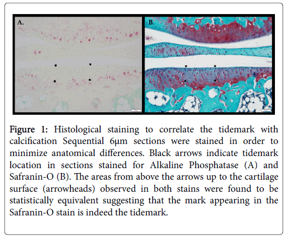 arthritis-minimize-anatomical