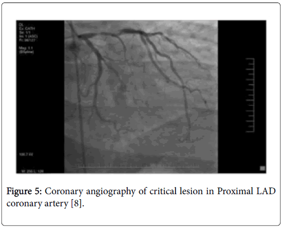 medical-reports-case-studies-coronary-angiography-critical