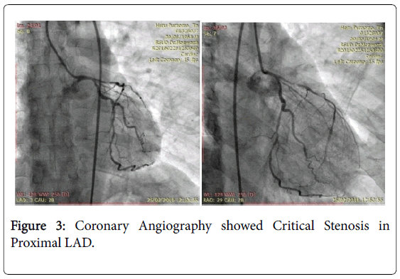 medical-reports-case-studies-coronary-angiography-stenosis