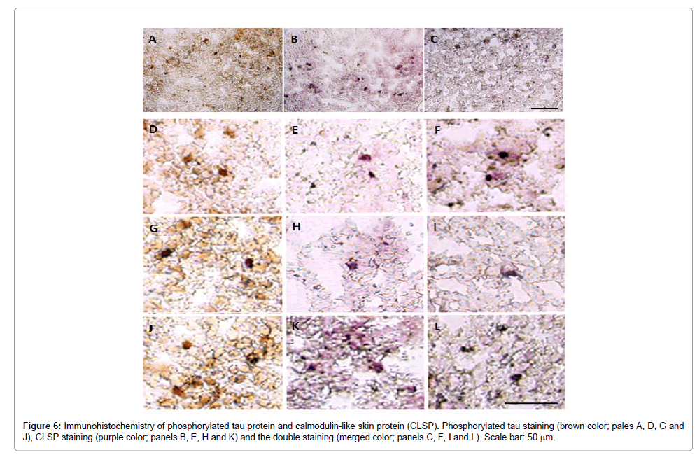 neurology-neurophysiology-Immunohistochemistry