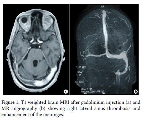 neurology-neurophysiology-T1-weighted-brain