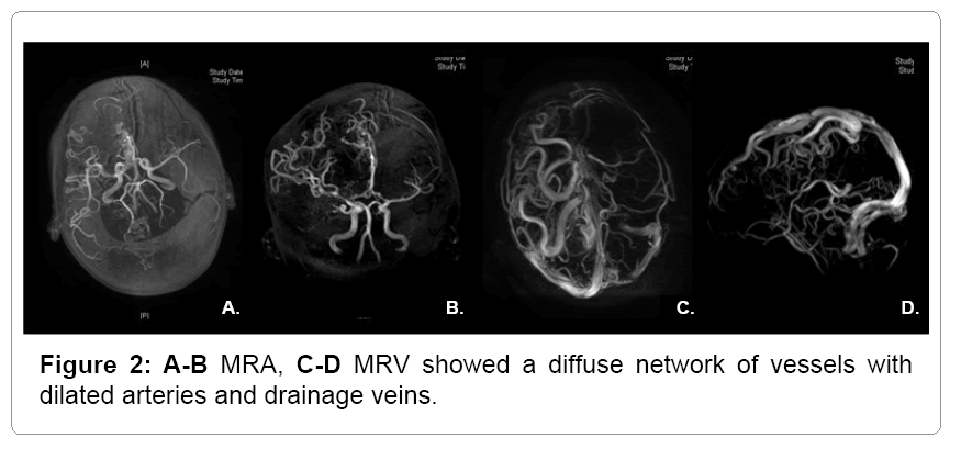 neurology-neurophysiology-diffuse-network-vessels