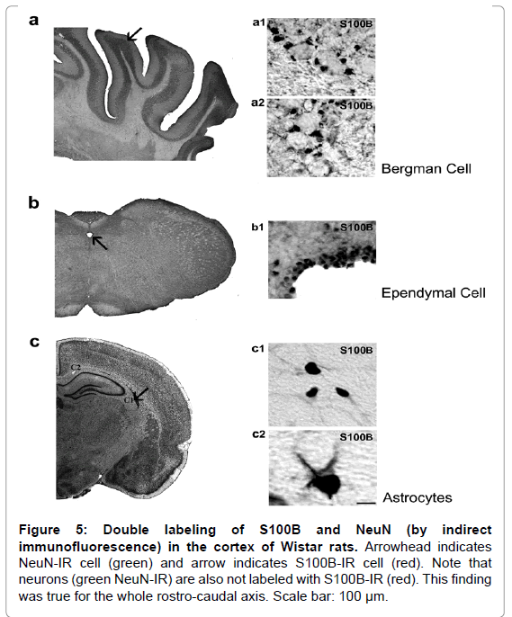 neurology-neurophysiology-rostro-caudal