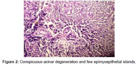 oncology-cancer-case-reports-Conspicuous-acinar