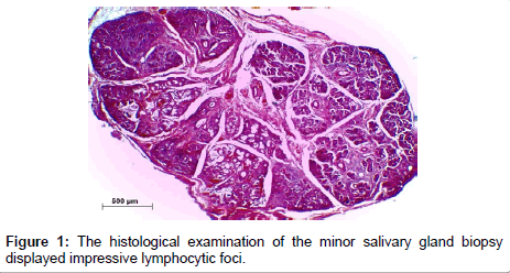 oncology-cancer-case-reports-histological-examination