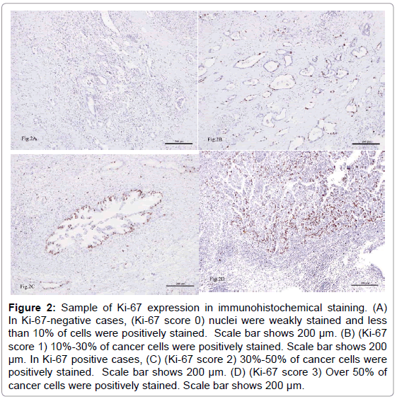 oncology-cancer-case-reports-immunohistochemical-nuclei-stained