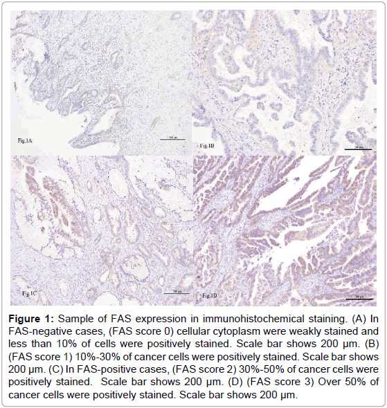oncology-cancer-case-reports-immunohistochemical-staining-cellular